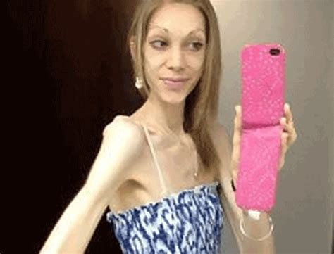 anorexic anal porn|Anorexic Anal Porn Videos .